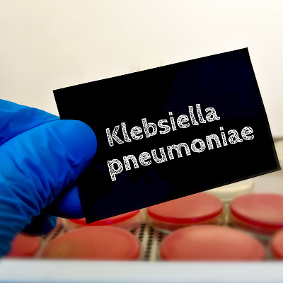 Euroopassa on yhä enemmän hypervirulentteja K. pneumoniae -kantoja