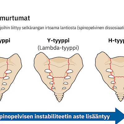 Vanhusten pienienergiaiset lantiorenkaan murtumat yleistyvät