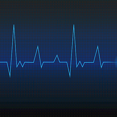EKG:llä voi arvioida pallolaajennuksella hoidetun sydäninfarktipotilaan ennustetta