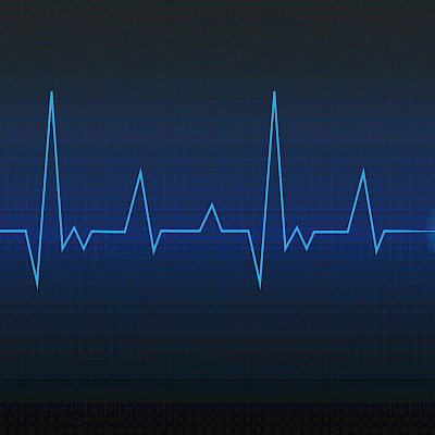 EKG:llä voi arvioida pallolaajennuksella hoidetun sydäninfarktipotilaan ennustetta