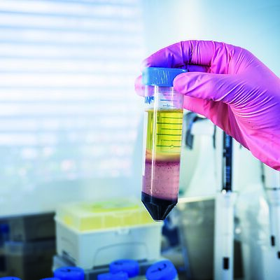 Biopankkiin tallennettu geenitieto hyödyttää verenluovutustoimintaa