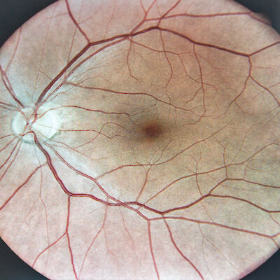 Health benefits of optometrists’ fundus scans are minimal