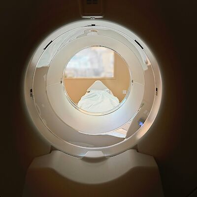 Oireettomien magneettikuvauksissa paljastuu runsaasti harmittomia löydöksiä