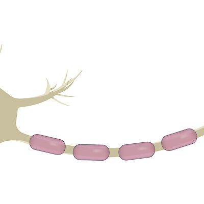 Alzheimerin taudin biologinen lääke aloitetaan huolellisesti