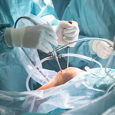 Ortopedisten leikkauspotilaiden sairauspoissaolot painottuvat sairaalan ulkopuolelle