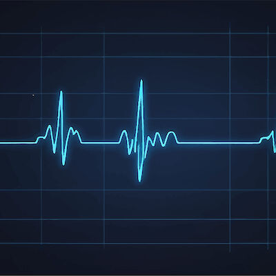 EKG paljastaa kohonneen aivoinfarktiriskin