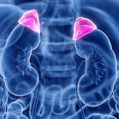 Jo tuhat primaarin aldosteronismin syytä selvittävää toimenpidettä