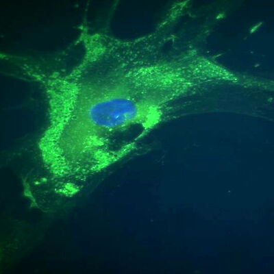 Kantasolusiirteitä välitettiin ennätysmäärä