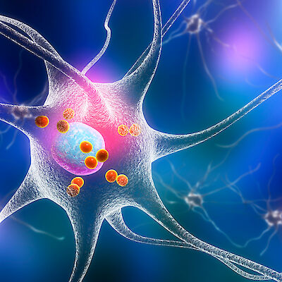 Varhaiseen Parkinsonin tautiin uusi ennustava verikoe?