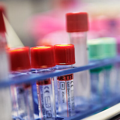 Uusi mekanismi selittää kemikaalien vaikutuksia sukupuolihormoneihin