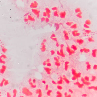 Englannin meningokokkiepidemian riski muualla Euroopassa pieni