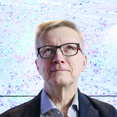 Tekoäly tulee ovista ja ikkunoista