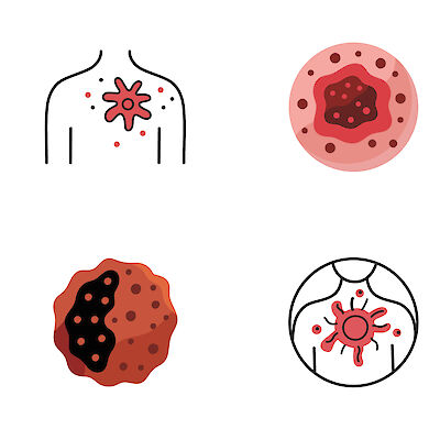 Ihomelanooman liitännäishoito täsmentyy