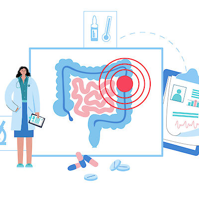 Ammattitermeillä on tiukka tarkkuusvaatimus