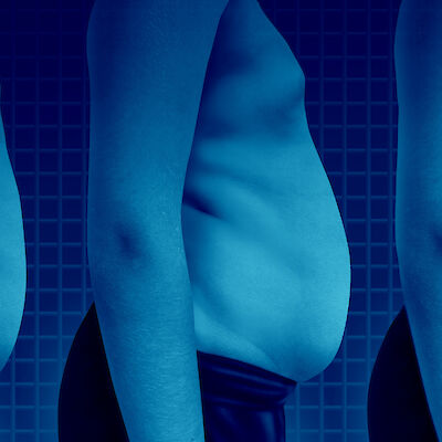 Lapsen metabolisesti terveeseen lihavuuteen liittyy pitkän aikavälin riskejä