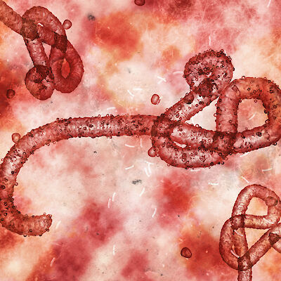 Hälyttävä ebolatilanne ei juuri heijastu Suomeen