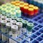 Tutkimus: laboratoriokokeiden lisääntymisen voi katkaista