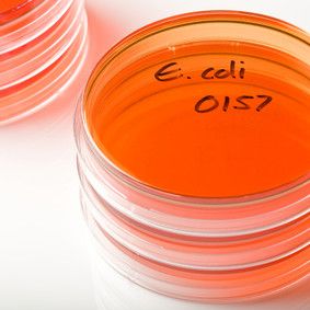 Antibioottiresistentit ESBL-bakteerikannat lisääntyvät Suomessa