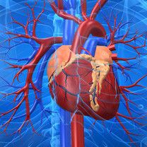 EMEA arvioi sibutramiinin haittoja