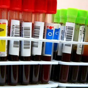 Mittayksikkö muuttuu diabeteksen hoidossa