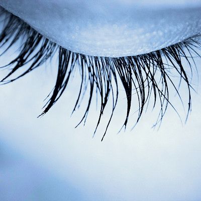 Silmäluomien tyvisolusyöpä yleistyy jatkuvasti