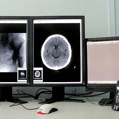 Tietokonetomografia on monivamma- ja tehohoitopotilaiden tutkimisen kulmakivi
