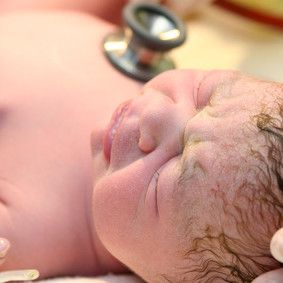 Synnytyskomplikaatiot hoituvat vanhoilla keinoilla