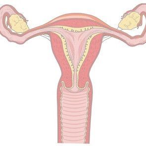 HPV-testi papa-kokeen rinnalle Käypä hoito -suosituksessa