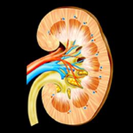 Dialyysineste kontaminoitunut