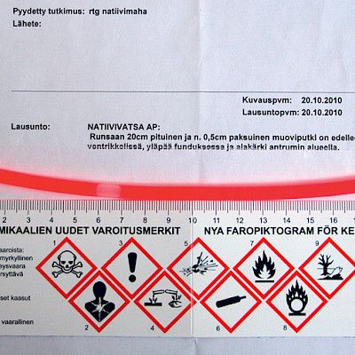 Case Kevätpörriäinen: Similia similibus curantur