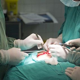 Umpilisäkkeen poisto antibiootteja tehokkaampaa