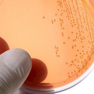 Laboratorioiden rutiinimenetelmässä parantamisen varaa