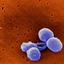 Uutta tietoa suomalaisista MRSA- ja pneumokokkikannoista