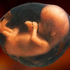 Äidin kemoterapia ei vaikuta sikiöön