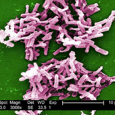 Ulosteensiirto on tehokkain keino antibioottiripulia vastaan