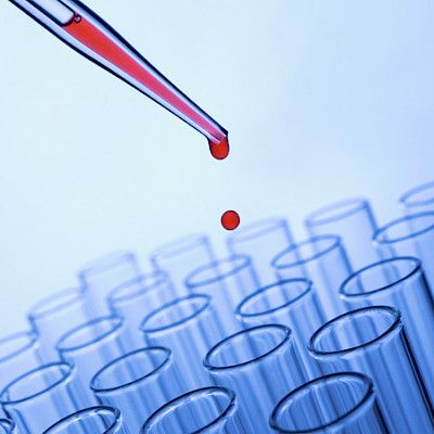Seulontatutkimusten valvonta kiristyy