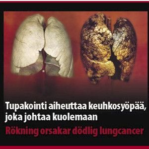 Tupakkatuotteisiin varoituskuvat aikaisintaan 2014