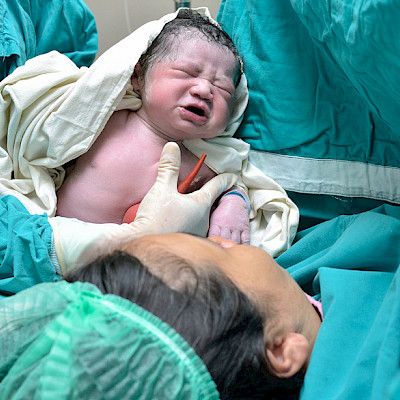 Sektiot yleisempiä ylipainoisilla synnyttäjillä
