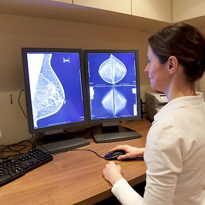 NEJM kysyi rintasyöpäseulonnoista  yllättävä tulos