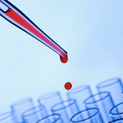 Biopankki kerää ja lainaa