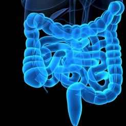 Suolibiopsia voi paljastaa keliaakikon lymfoomariskin