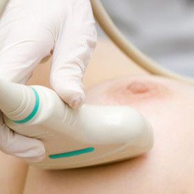 Seulonnassa löydetyissä rintasyövissä enemmän hyväennusteisia