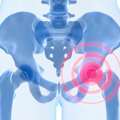 Ultraäänimittauksilla tarkempaa tietoa osteoporoosista