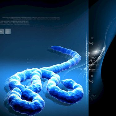 Espanjan Ebola-tartunta muistuttaa varautumisen tarpeesta